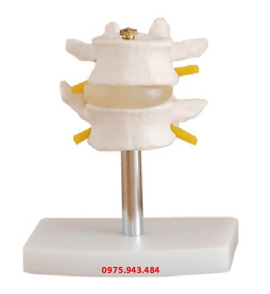 Mô hình đốt xương sống thắt lưng (2 chiếc) XC-116